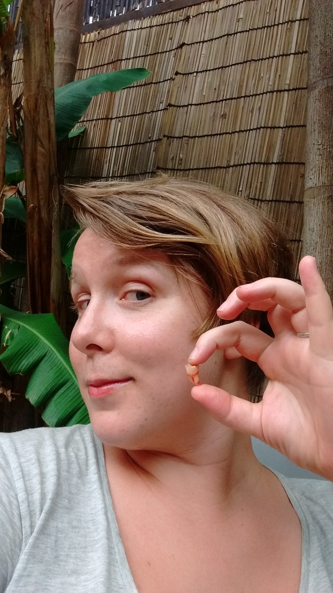 IMG_20170413_173359433_TOP